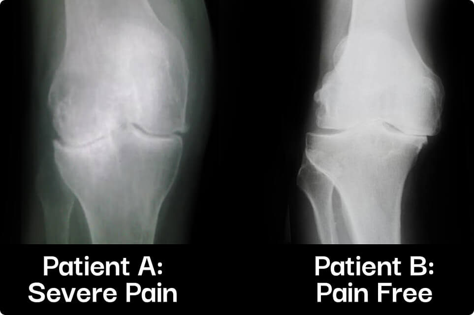 xrays from two different patients